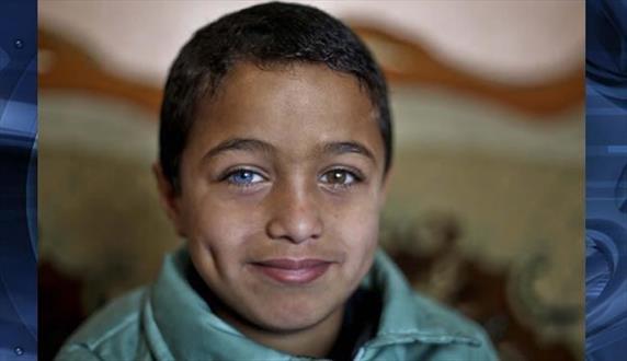  دردسر کودک فلسطینی به خاطر رنگ چشم ! +تصاویر 
