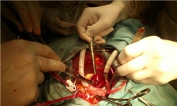 رکوردزنی جراح قرقیزی در انجام عمل قلب