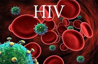افزایش مبتلایان به ایدز در روسیه 